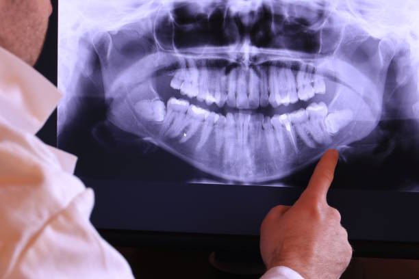 Best Emergency Dental Care for Broken or Chipped Teeth in Minier, IL