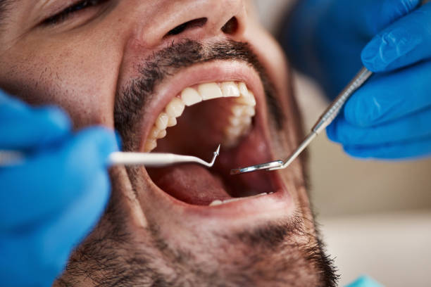 Best Emergency Treatment for Dental Infections or Abscesses in Minier, IL